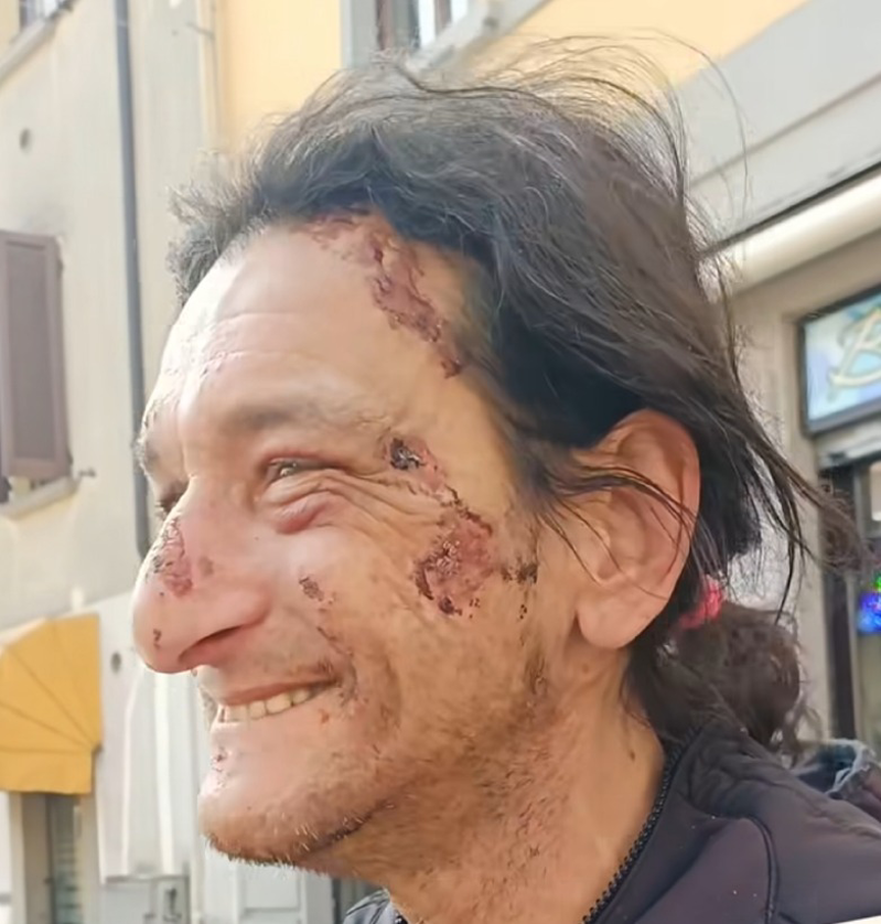 Lodi - Il “Pinci” sta meglio