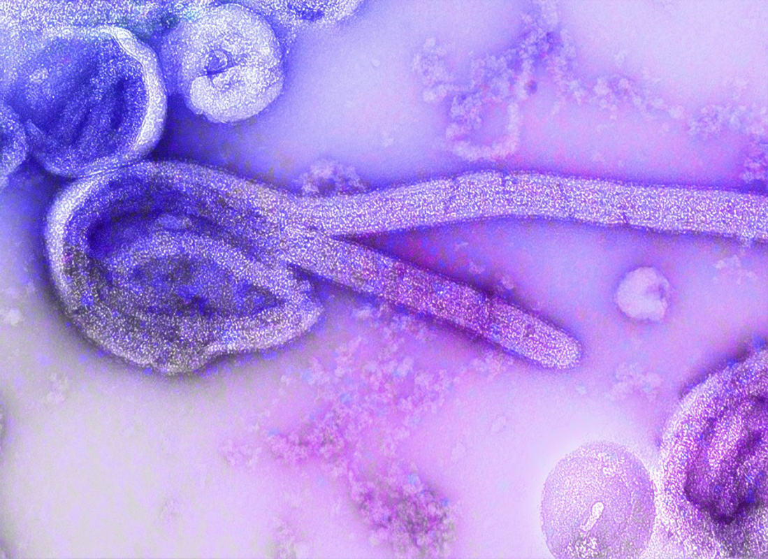Lodi - Toxoplasmosi, prevenzione e consapevolezza